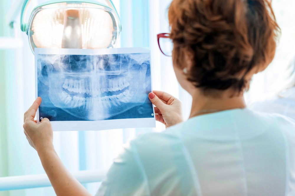 A dentist holding a dental X-ray up to the light to examine it