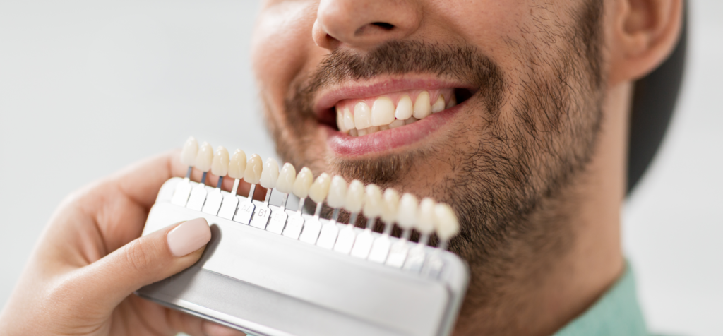 porcelain veneers