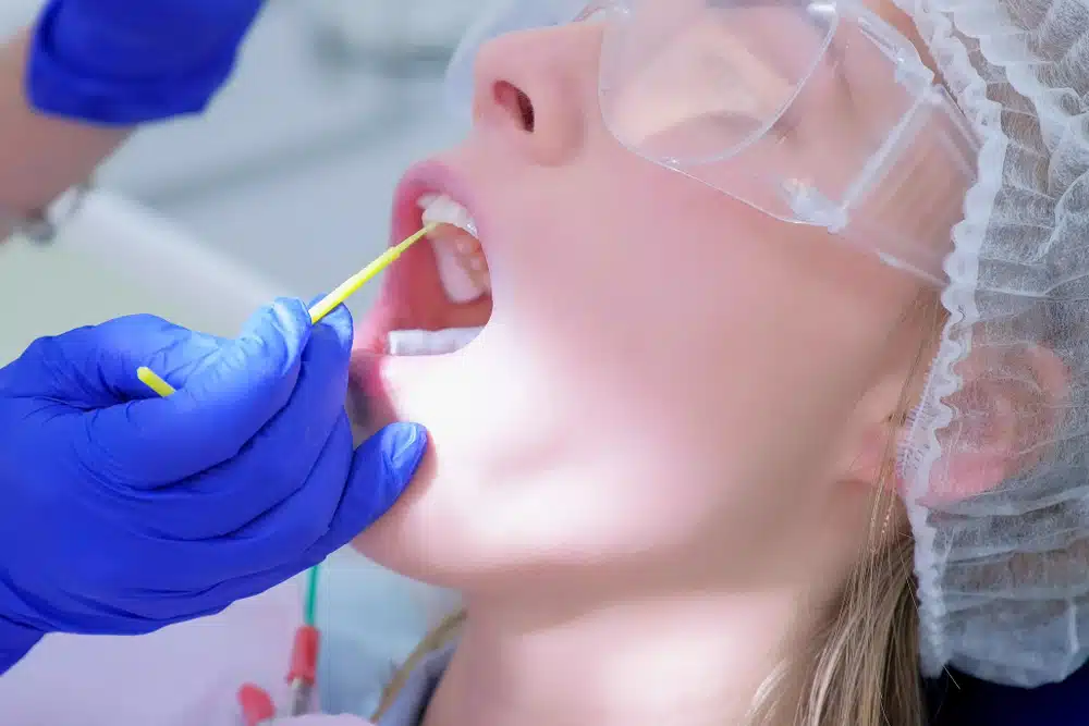 dental sealants aspen